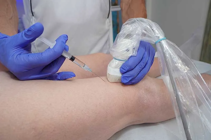 Therapeutische Infiltration Injektion Palma